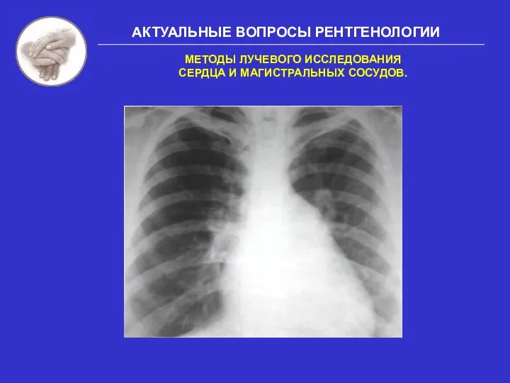 АКТУАЛЬНЫЕ ВОПРОСЫ РЕНТГЕНОЛОГИИ МЕТОДЫ ЛУЧЕВОГО ИССЛЕДОВАНИЯ СЕРДЦА И МАГИСТРАЛЬНЫХ СОСУДОВ.