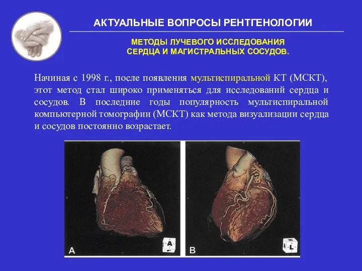 АКТУАЛЬНЫЕ ВОПРОСЫ РЕНТГЕНОЛОГИИ МЕТОДЫ ЛУЧЕВОГО ИССЛЕДОВАНИЯ СЕРДЦА И МАГИСТРАЛЬНЫХ СОСУДОВ.