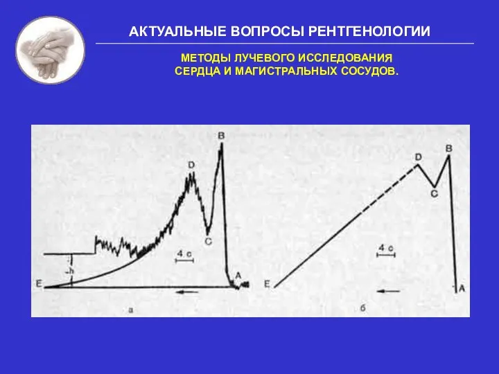 АКТУАЛЬНЫЕ ВОПРОСЫ РЕНТГЕНОЛОГИИ МЕТОДЫ ЛУЧЕВОГО ИССЛЕДОВАНИЯ СЕРДЦА И МАГИСТРАЛЬНЫХ СОСУДОВ.