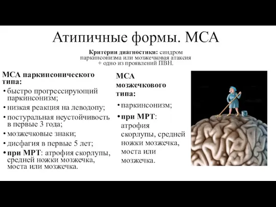 Атипичные формы. МСА Критерии диагностики: синдром паркинсонизма или мозжечковая атаксия