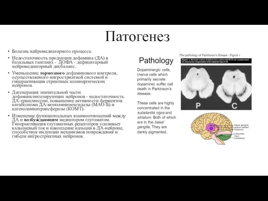 Патогенез Болезнь нейромедиаторного процесса. Недостаточность продукции дофамина (ДА) в базальных