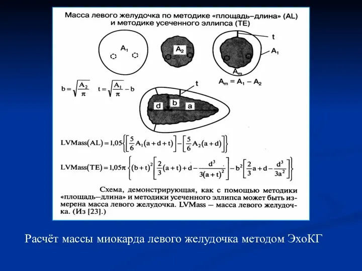 Расчёт массы миокарда левого желудочка методом ЭхоКГ