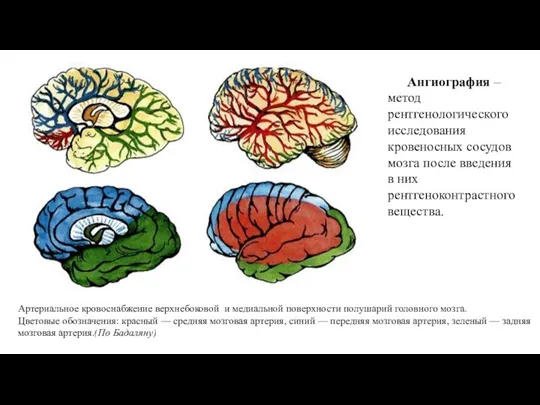 Артериальное кровоснабжение верхнебоковой и медиальной поверхности полушарий головного мозга. Цветовые обозначения: красный —