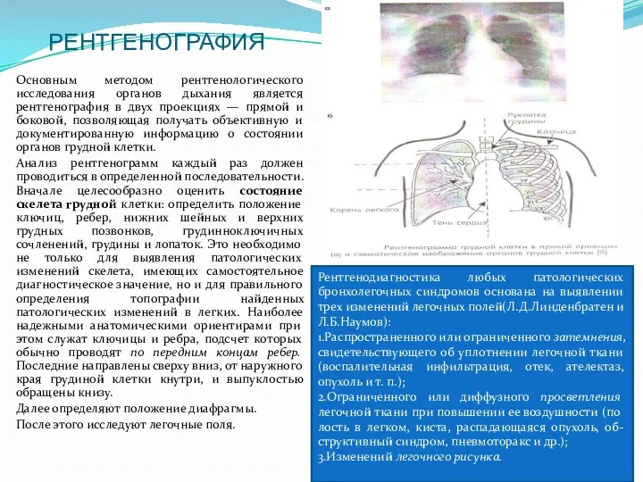 РЕНТГЕНОГРАФИЯ Основным методом рентгенологического исследования органов дыхания является рентгенография в