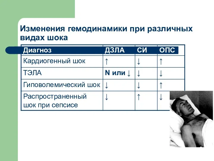 Изменения гемодинамики при различных видах шока