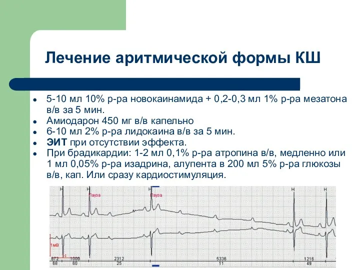 Лечение аритмической формы КШ 5-10 мл 10% р-ра новокаинамида +