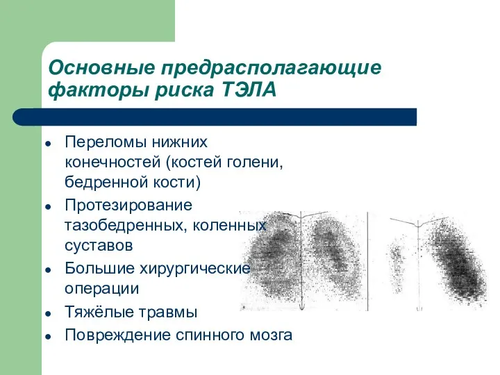 Основные предрасполагающие факторы риска ТЭЛА Переломы нижних конечностей (костей голени,