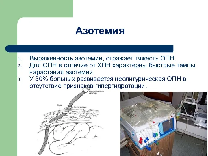 Азотемия Выраженность азотемии, отражает тяжесть ОПН. Для ОПН в отличие