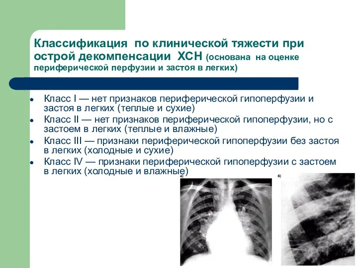 Классификация по клинической тяжести при острой декомпенсации ХСН (основана на