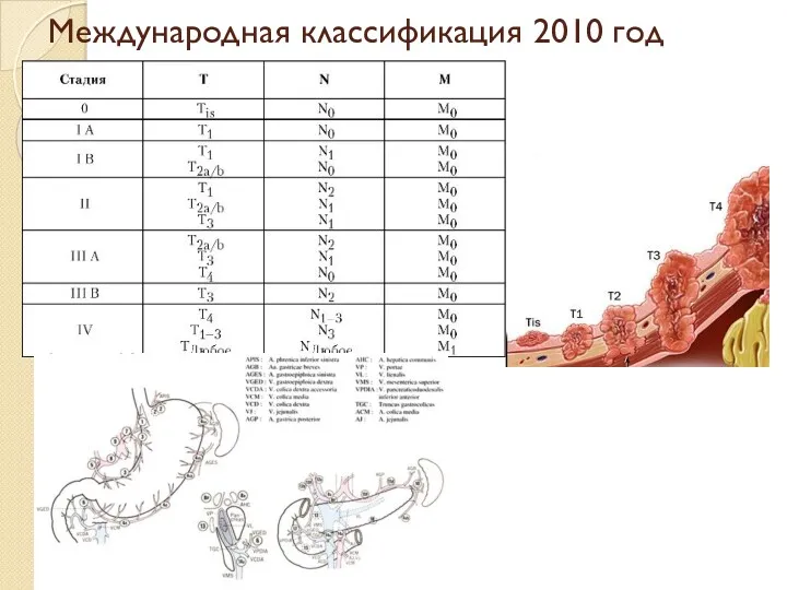Международная классификация 2010 год