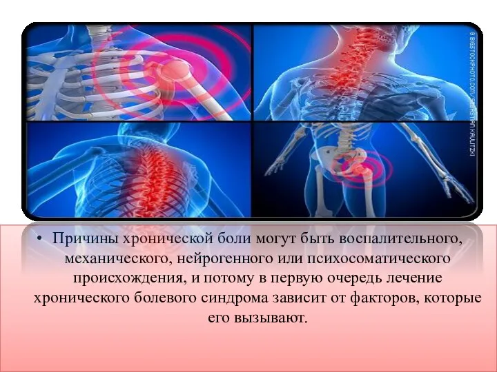 Причины хронической боли могут быть воспалительного, механического, нейрогенного или психосоматического