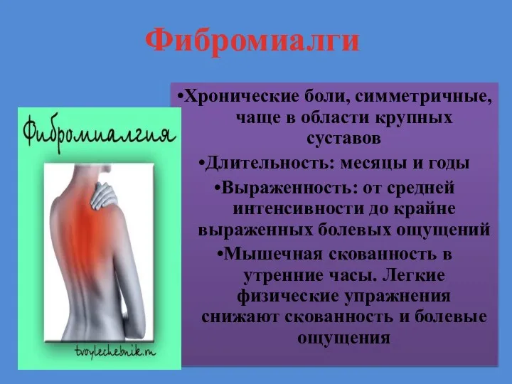 Фибромиалги •Хронические боли, симметричные, чаще в области крупных суставов •Длительность: