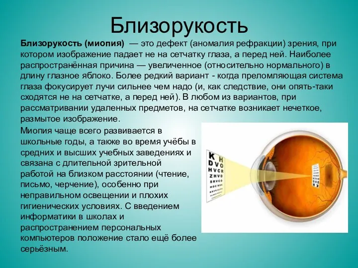 Близорукость Близорукость (миопия) — это дефект (аномалия рефракции) зрения, при