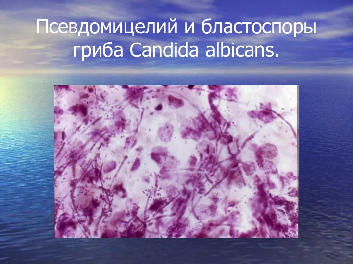 Псевдомицелий и бластоспоры гриба Candida albicans.