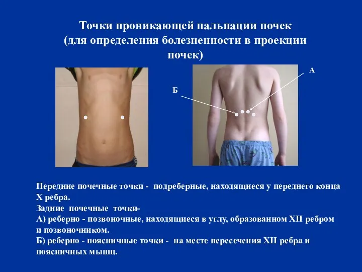 Точки проникающей пальпации почек (для определения болезненности в проекции почек)