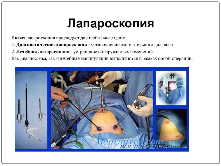 Лапароскопия Любая лапароскопия преследует две глобальные цели: 1. Диагностическая лапароскопия