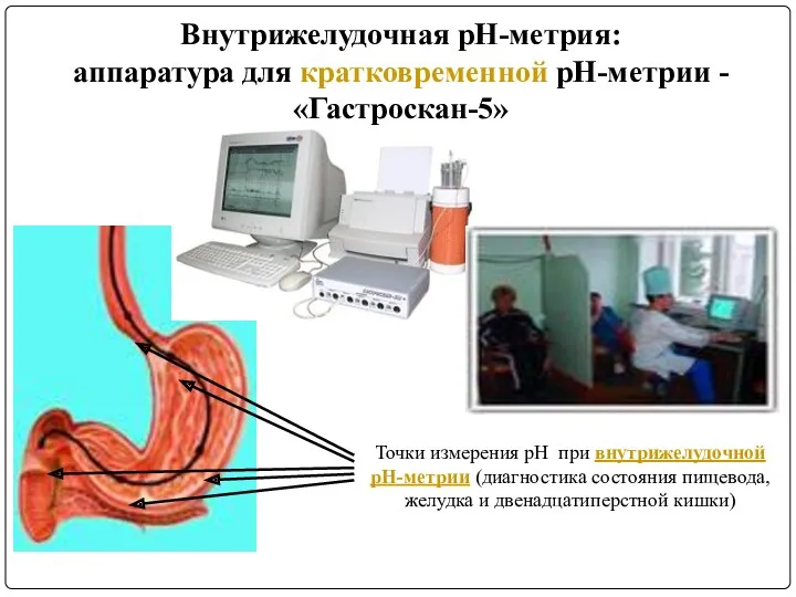 Точки измерения рН при внутрижелудочной pH-метрии (диагностика состояния пищевода, желудка