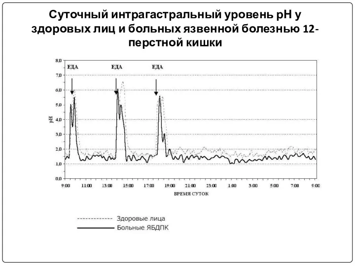 Суточный интрагастральный уровень рН у здоровых лиц и больных язвенной болезнью 12-перстной кишки