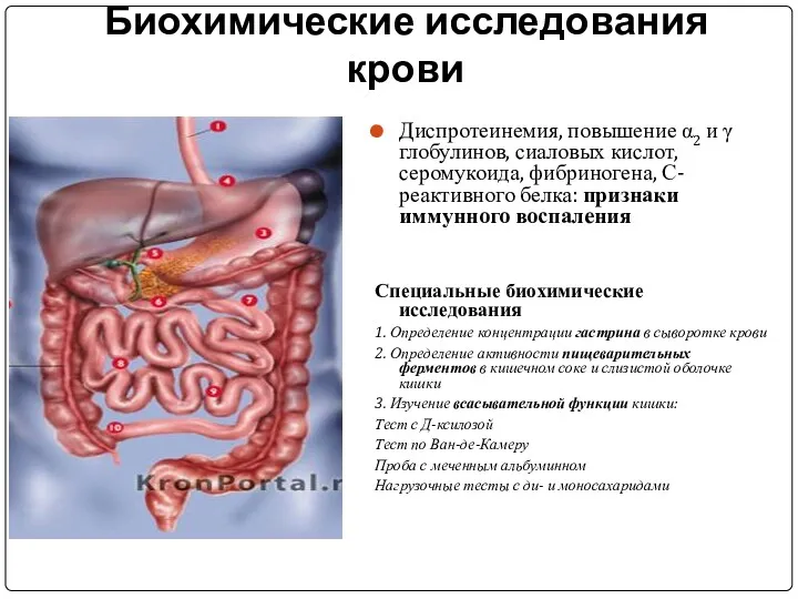 Биохимические исследования крови Диспротеинемия, повышение α2 и γ глобулинов, сиаловых