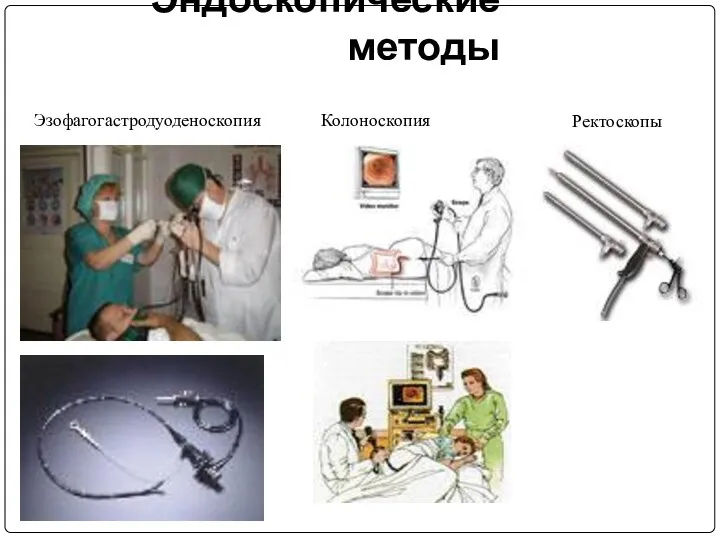 Эндоскопические методы Ректоскопы Колоноскопия Эзофагогастродуоденоскопия