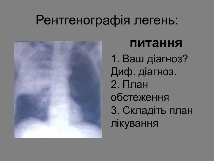 Рентгенографія легень: питання 1. Ваш діагноз? Диф. діагноз. 2. План обстеження 3. Складіть план лікування