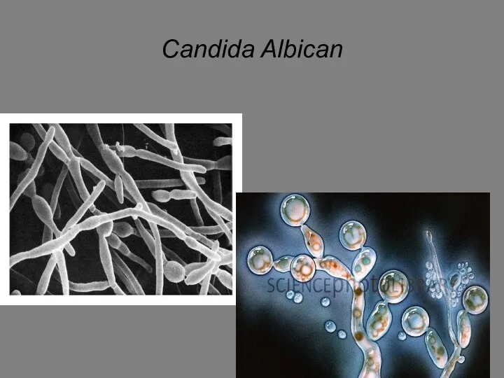 Candida Albican