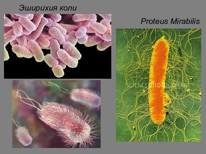 Эширихия коли Proteus Mirabilis