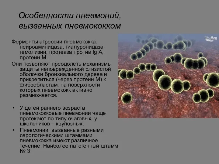 Особенности пневмоний, вызванных пневмококком Ферменты агрессии пневмококка: нейроаминидаза, гиалуронидаза, гемолизин,