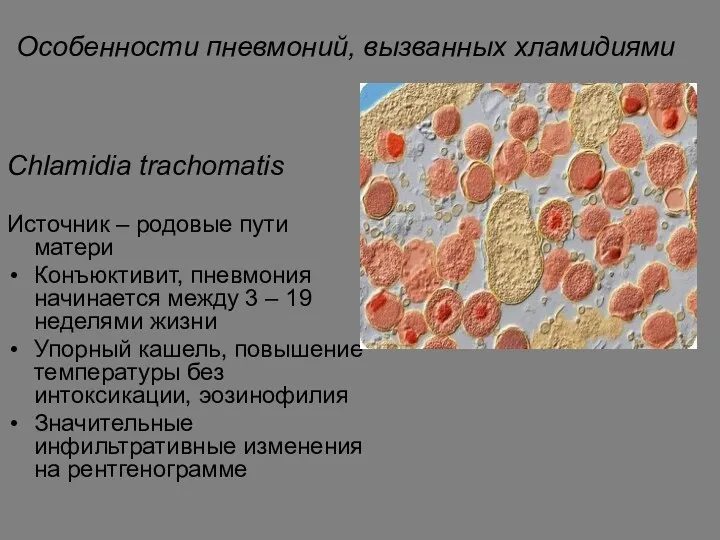Особенности пневмоний, вызванных хламидиями Chlamidia trachomatis Источник – родовые пути матери Конъюктивит, пневмония