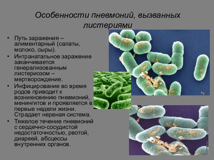 Особенности пневмоний, вызванных листериями Путь заражения – алиментарный (салаты, молоко,