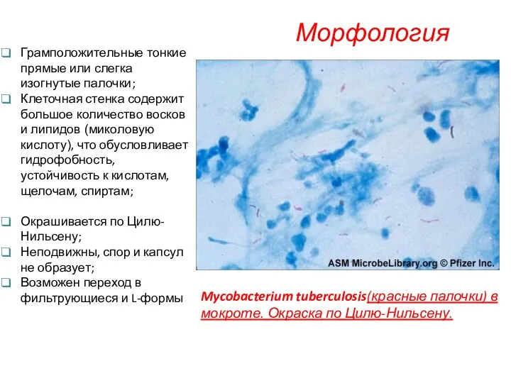 Морфология Mycobacterium tuberculosis(красные палочки) в мокроте. Окраска по Цилю-Нильсену. Грамположительные