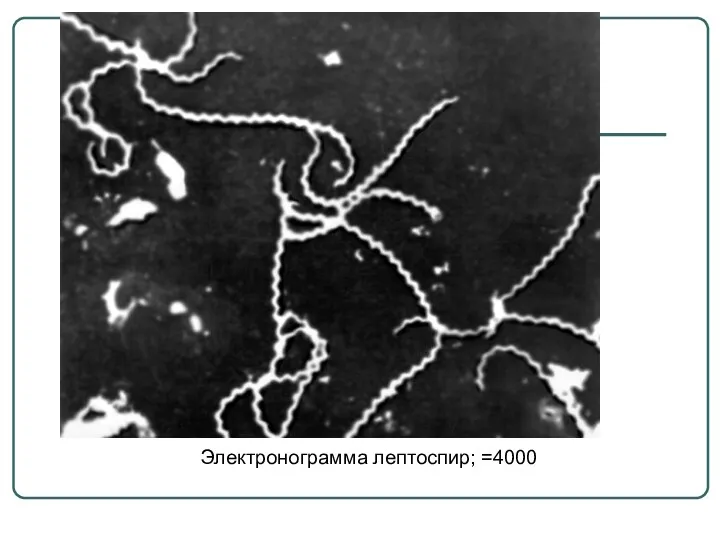 Электронограмма лептоспир; =4000