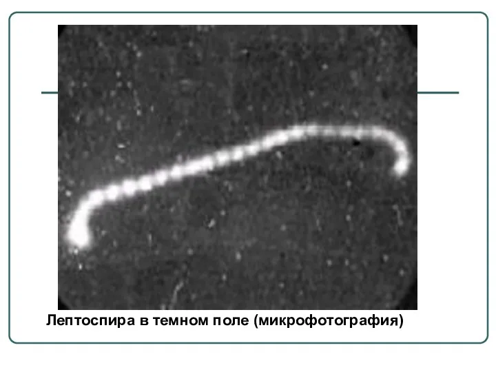 Лептоспира в темном поле (микрофотография)