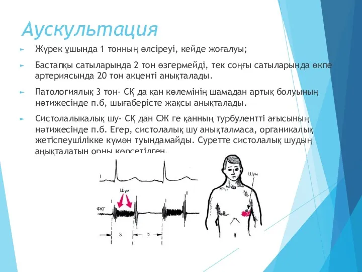 Аускультация Жүрек ұшында 1 тонның әлсіреуі, кейде жоғалуы; Бастапқы сатыларында