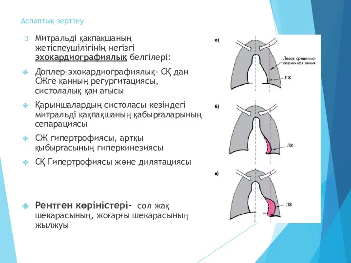 Аспаптық зерттеу Митральді қақпақшаның жетіспеушілігінің негізгі эхокардиографиялық белгілері: Доплер-эхокардиографиялық- СҚ