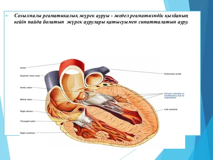 Созылмалы ревматикалық жүрек ауруы - жедел ревматизмдік қызбаның кейін пайда болатын жүрек аурулары қатысуымен сипатталатын ауру.
