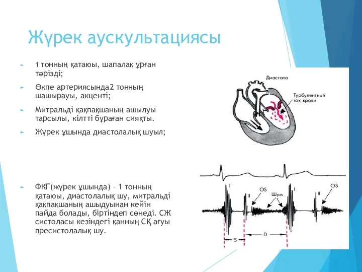 Жүрек аускультациясы 1 тонның қатаюы, шапалақ ұрған тәрізді; Өкпе артериясында2