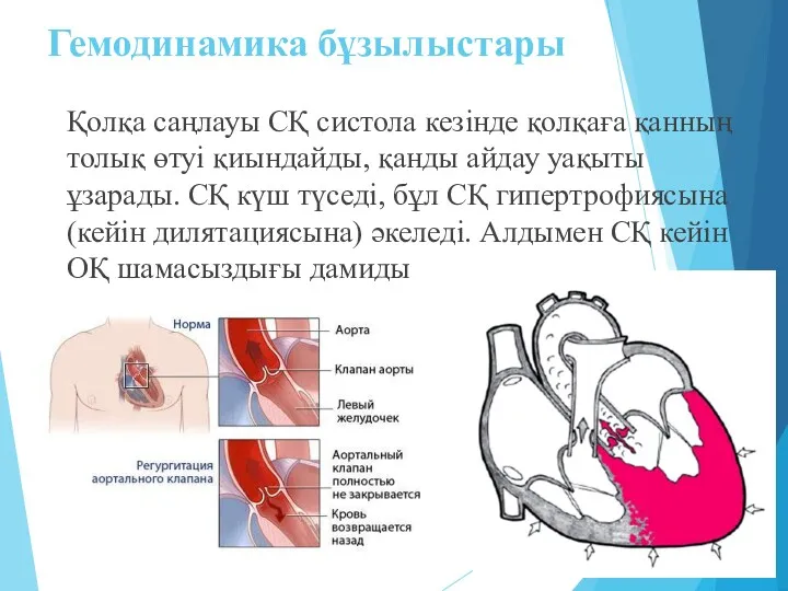 Гемодинамика бұзылыстары Қолқа саңлауы СҚ систола кезінде қолқаға қанның толық