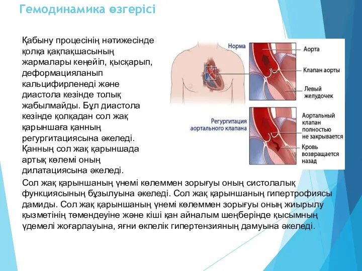 Гемодинамика өзгерісі Қабыну процесінің нәтижесінде қолқа қақпақшасының жармалары кеңейіп, қысқарып,