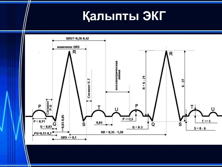 Қалыпты ЭКГ