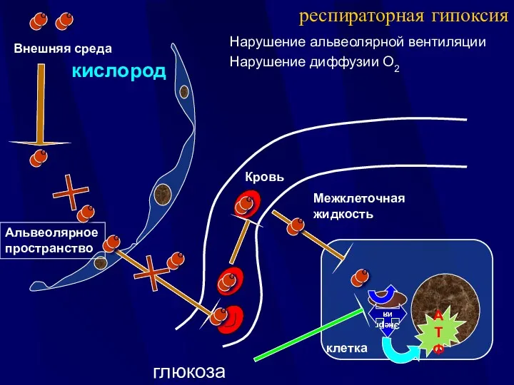 Внешняя среда Межклеточная жидкость респираторная гипоксия Нарушение альвеолярной вентиляции Нарушение диффузии О2 кислород