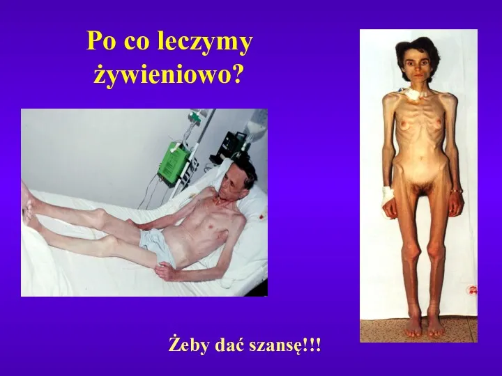 Po co leczymy żywieniowo? Żeby dać szansę!!!