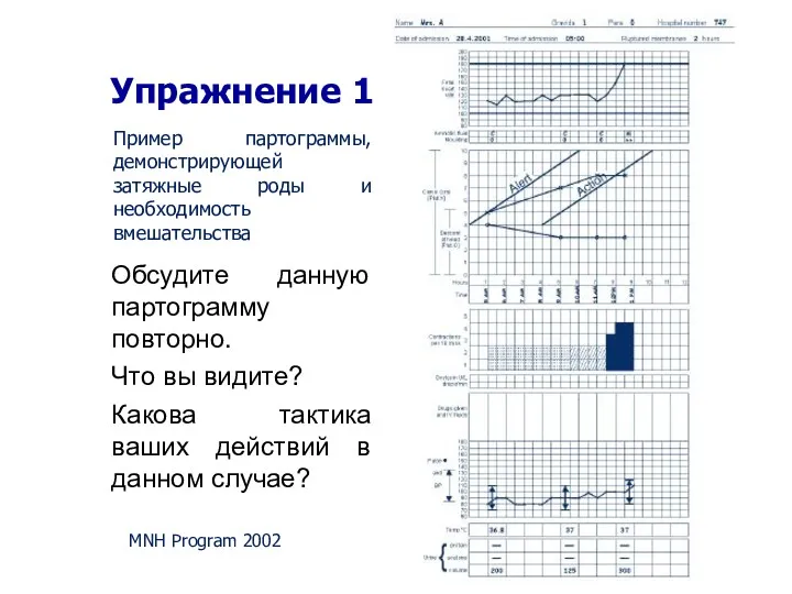 Упражнение 1 MNH Program 2002 Пример партограммы, демонстрирующей затяжные роды