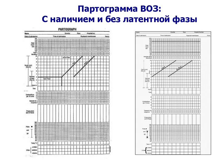 Партограмма ВОЗ: С наличием и без латентной фазы WHO 2007