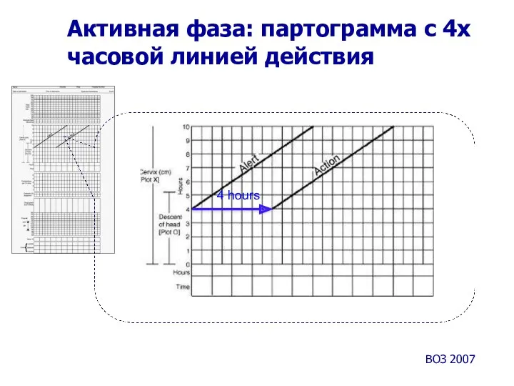 Активная фаза: партограмма с 4х часовой линией действия 4 hours ВОЗ 2007