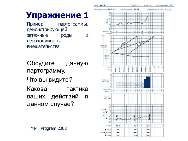 Упражнение 1 MNH Program 2002 Пример партограммы, демонстрирующей затяжные роды