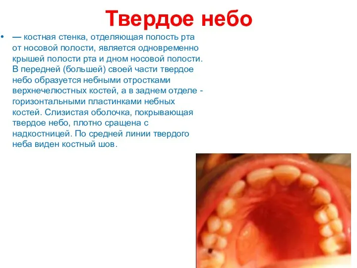 Твердое небо — костная стенка, отделяющая полость рта от носовой