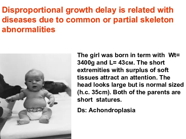 Disproportional growth delay is related with diseases due to common