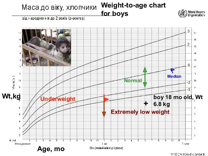 Median Underweight Normal Extremely low weight + boy 18 mo
