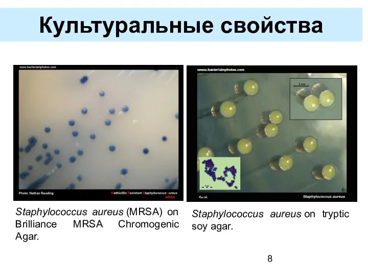 Культуральные свойства Staphylococcus aureus (MRSA) on Brilliance MRSA Chromogenic Agar. Staphylococcus aureus on tryptic soy agar.